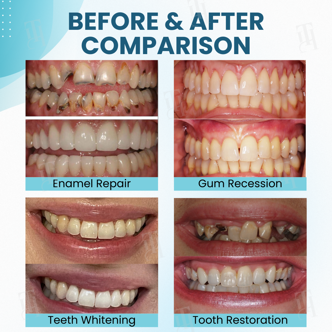 AEXZR Makesmile Powder - Stronger Teeth & Gums + 50% OFF