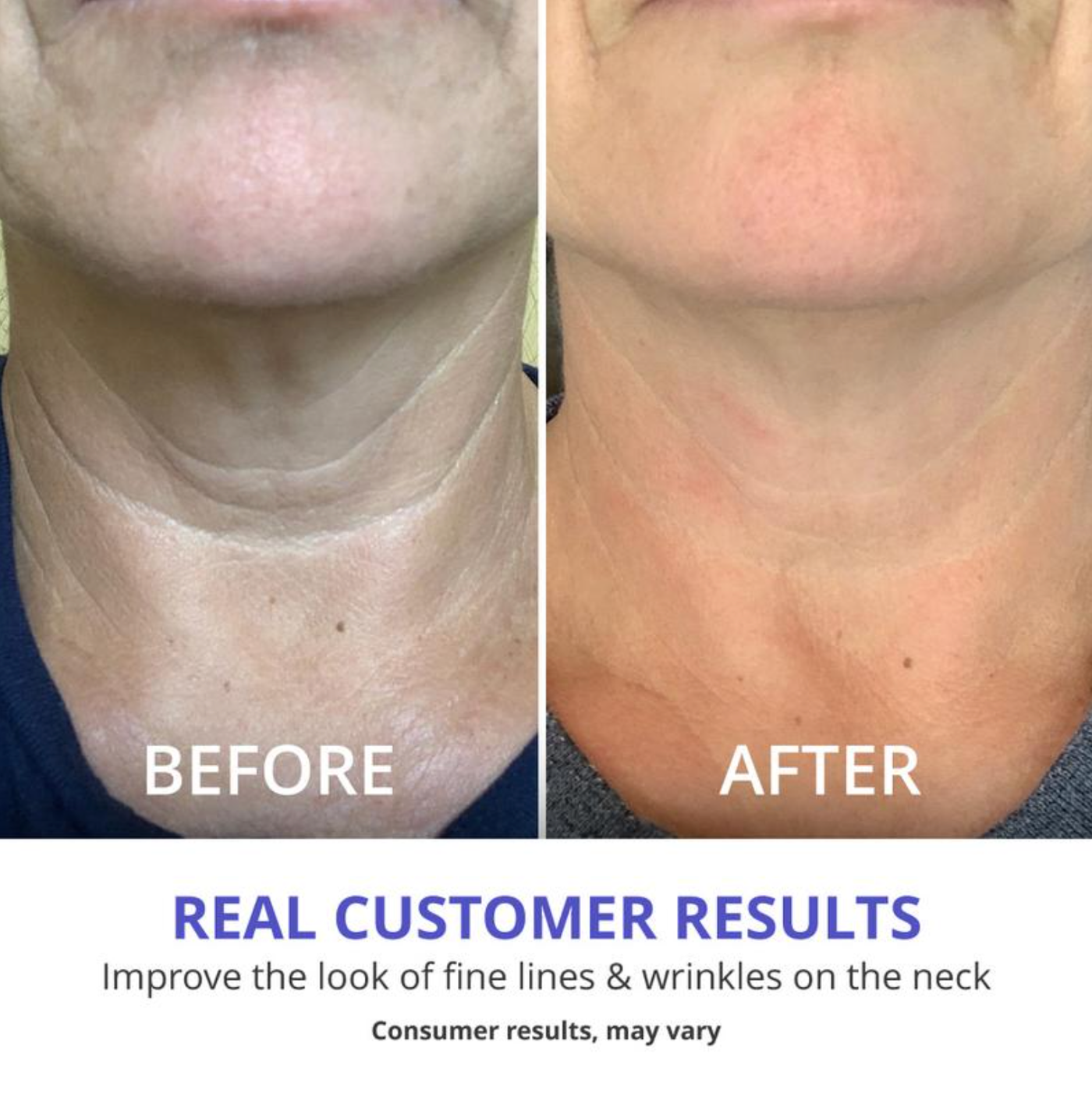 AuraLift Neck & Décolleté Sculpting Cream - A Firmer, Lifted Look + 50% OFF