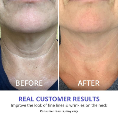 AuraLift Neck & Décolleté Sculpting Cream - A Firmer, Lifted Look + 50% OFF