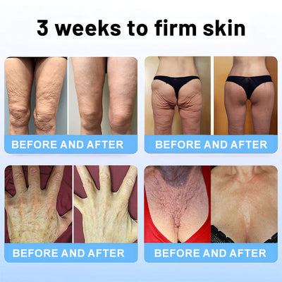 ElastiTox Firming Serum Stick – Sculpt, Lift, Defy Gravity - 50% OFF