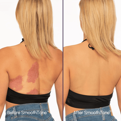 DermaBlend Perfector – Your Flawless Skin Canvas - 50% OFF