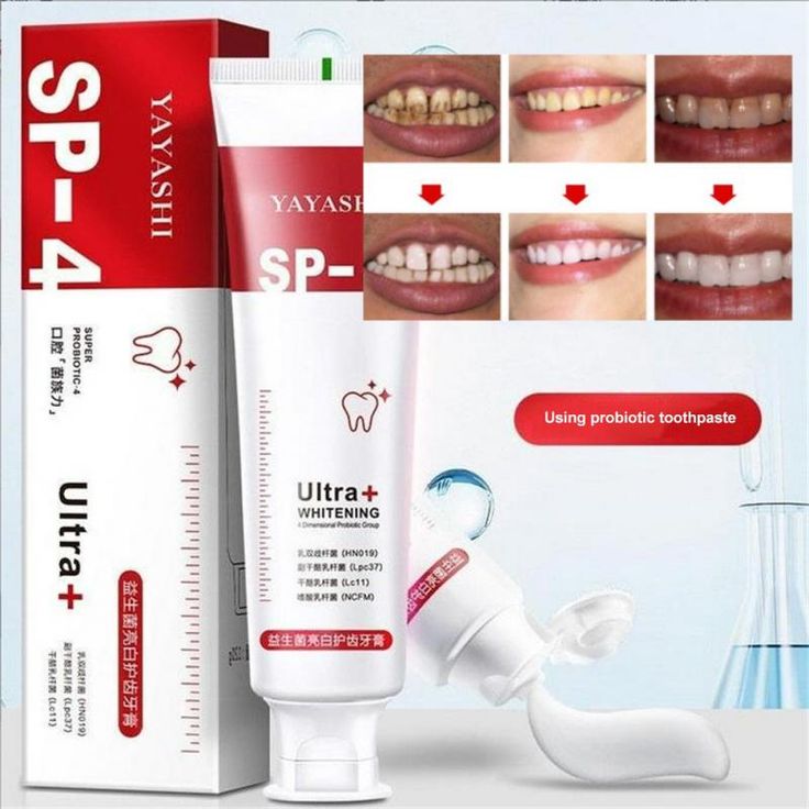 SP-4 Whitening Toothpaste – Gentle Daily Formula Stain Removal - 50% OFF