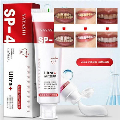 SP-4 Whitening Toothpaste – Gentle Daily Formula Stain Removal - 50% OFF