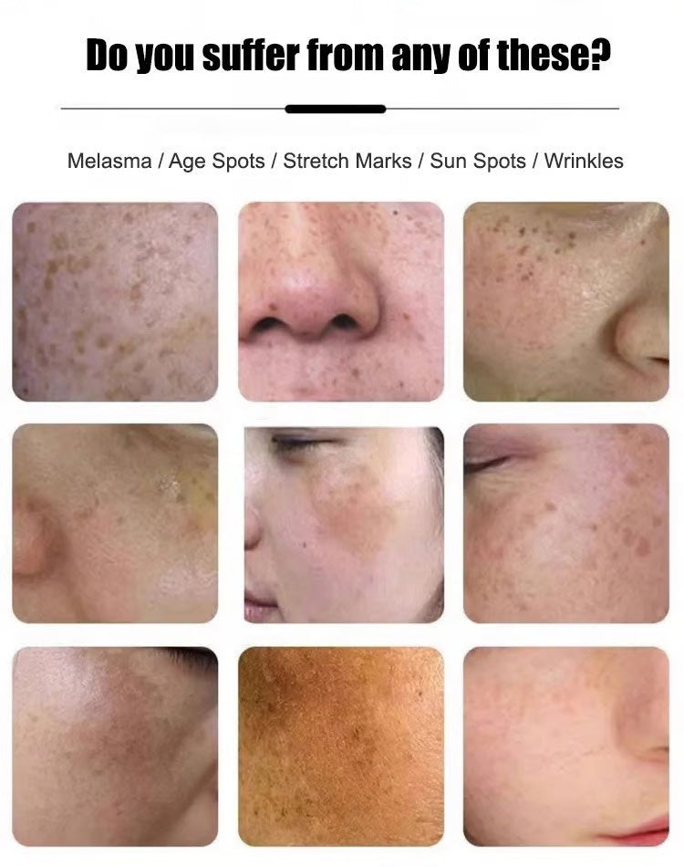 Anti-Blemish & Anti-Aging Tear-Off Mask – Deep Pore Detox - 1+1 FREE