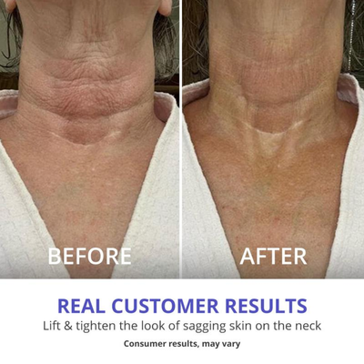AuraLift Neck & Décolleté Sculpting Cream - A Firmer, Lifted Look + 50% OFF